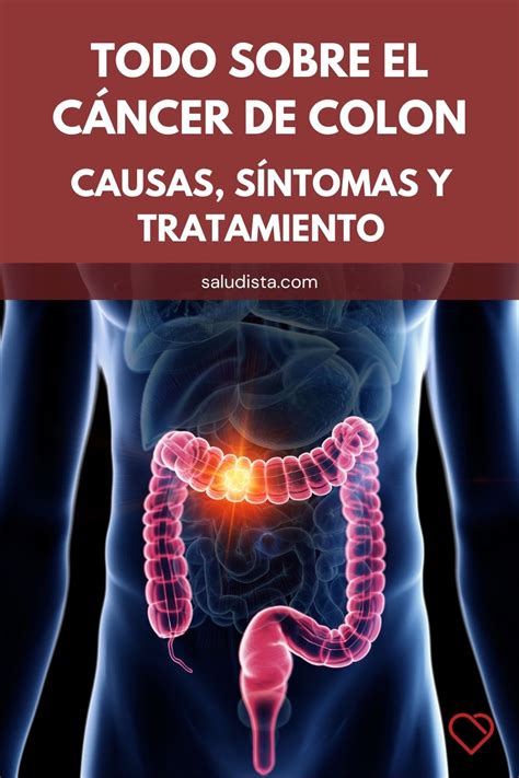 Sintomas Del Cancer De Colon