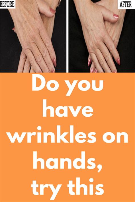 Do You Have Wrinkles On Hands Try This Hand Wrinkles Are Very Common