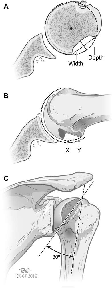axillary view    shoulder shows congruency