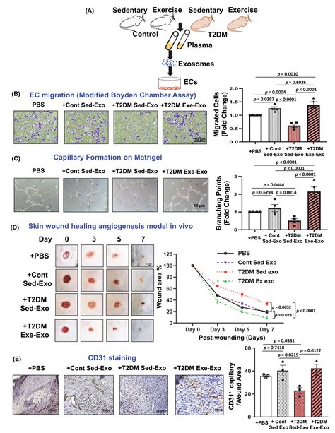 Exercise Improves Angiogenic Function Of Circulating Exosomes In Type 2