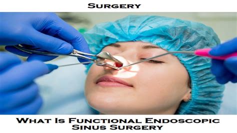 What Is Functional Endoscopic Sinus Surgery Youtube