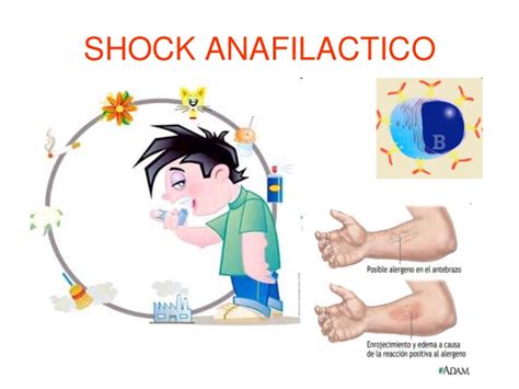 shock - Del Prado Socorristas