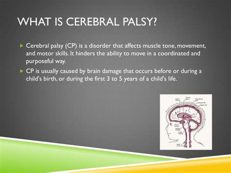 PPT Cerebral Palsy PowerPoint Presentation ID 1985358