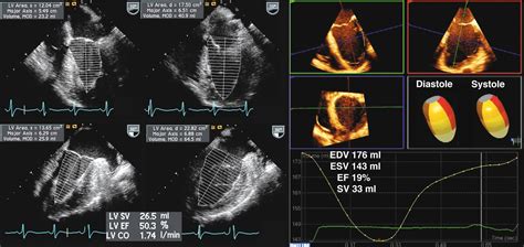 Intraoperative And Interventional Echocardiography Clinical Tree