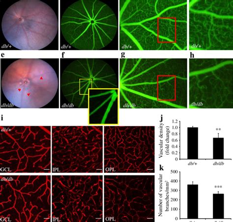 Retinal Vascular Degeneration In Db Db Mice Ah Representative