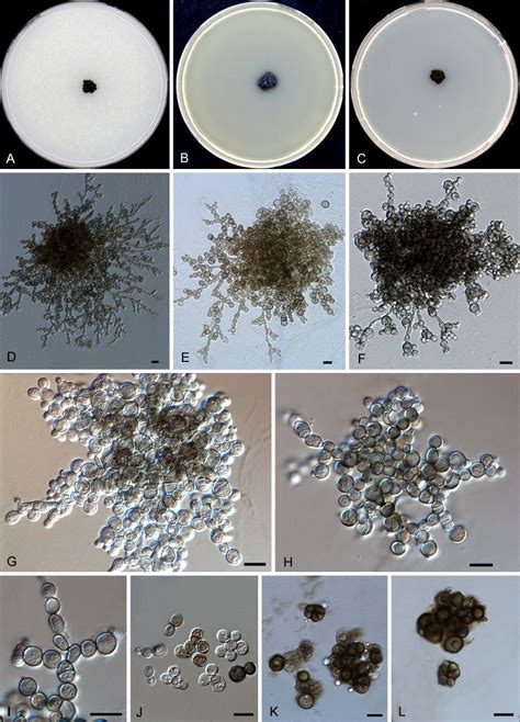 Exophiala Phaeomuriformis Atlas Of Clinical Fungi