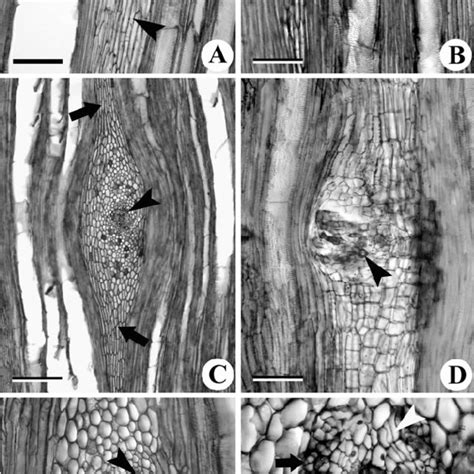 Transverse A C D And Tangential Longitudinal B View Of The Stem Download Scientific