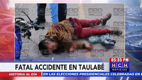 Muri Al Instante Motociclista Muere Al Impactar De Frente Contra