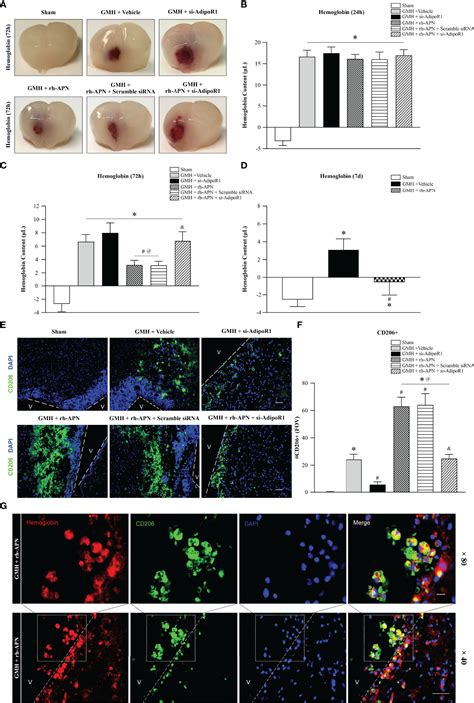 Germinal Matrix Hemorrhage Induces Immune Responses Brain 59 Off