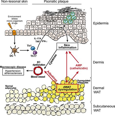 Dermal Adipocytes Claim For Fame In Psoriasis Brembilla 2017