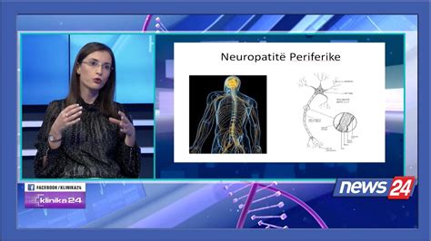 Neuropatite Periferike Klinika Diagnoza E Trajtimi Dje Dhe Sot Meri