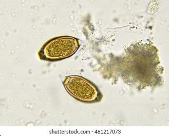 Eggs Trichuris Trichiura Whipworm Stool Analyze Stock Photo 647178955