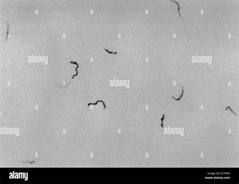 Treponema Pallidum Shown Under Dark Field Light Microscopy Stock Photo