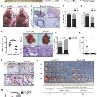 Mir P Inhibits Tumor Growth Metastasis And Tumorigenesis Of Hnscc