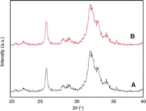 Synthesis And Characterization Of Pure And Nanosized Hydroxyapatite