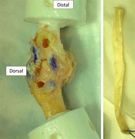 Mechanical Evaluation Of Knee Ligament Allografts For Thumb