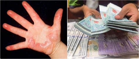 Father Throws Hot Water On His Jobless Son After Arguing