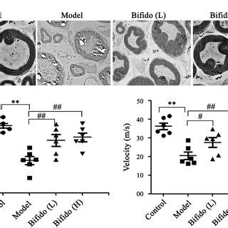 The effects of B. infantis on morphology and function of sciatic nerves... | Download Scientific ...