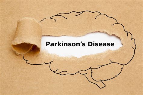 World S First Biomarker For Efficient Parkinson S Disease Diagnosis