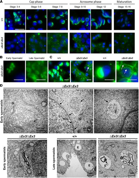 Impaired Proacrosomal Vesicular Transport In Vps13bEx3 Ex3