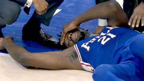 Philadelphia 76ers Joel Embiid Undergoes Surgery For Fractured Orbital