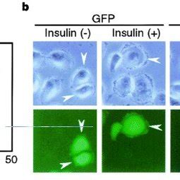 Involvement Of LIMK 1 In Insulin Induced Formation Of Membrane