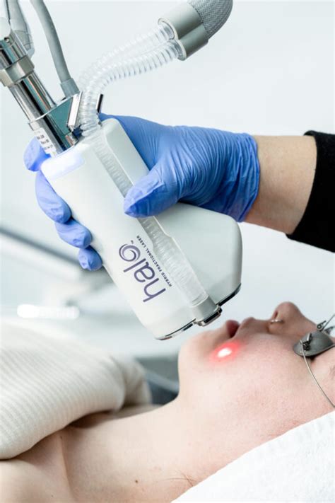 Sciton HALO Laser Skin Rejuvenation Green Leaf Pebble Med Spa