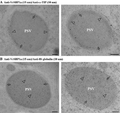 Immunogold Em Double Labelling Study Ultrathin Sections Prepared From