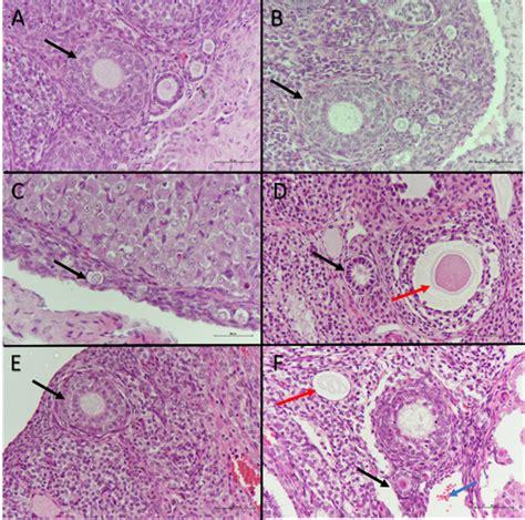 Figure Photomicrographs Of Hematoxylin And Eosin Stained Ovarian