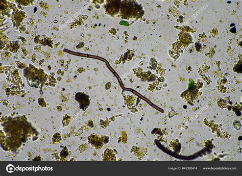 Soil Microorganisms Soil Sample Soil Fungus Bacteria Regenerative Farm ...