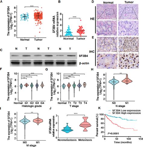 Sf B Promotes Twist Expression And Clear Cell Renal Cell Carcinoma