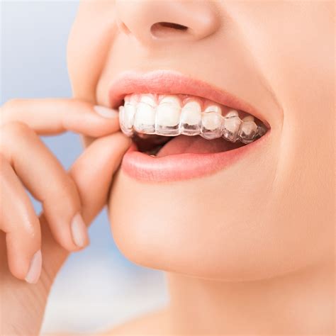 Invisalign Teeth Straightening Chalfont St Peter Gerrards Cross