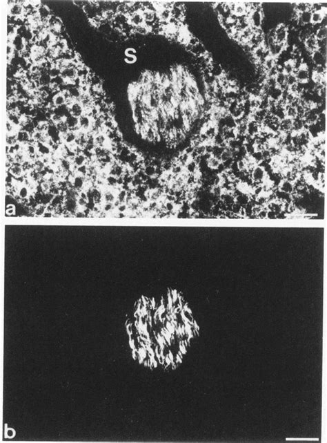 Double Label Immunofluorescence Microscopy Of A Frozen Section Of A