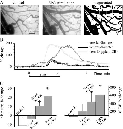 Figure From Stimulation Of The Sphenopalatine Ganglion Induces