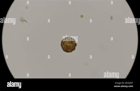 Egg Worm Parasitic Nematodes Under The Microscope Stock Video Footage Alamy