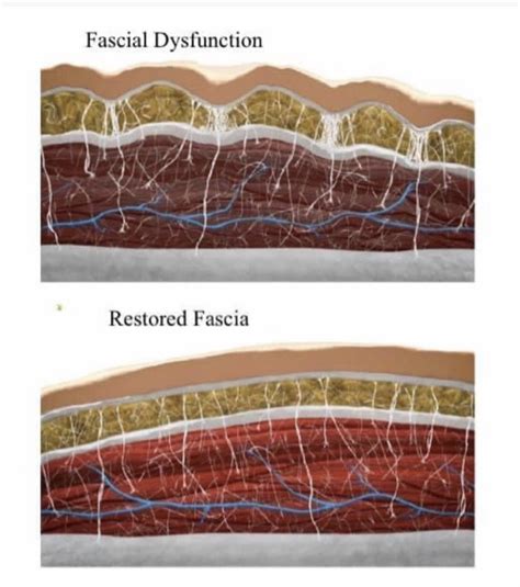 The Fascia System Ohana Yoga Studio