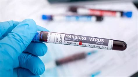 Virus Marburg symptômes traitement et prévention