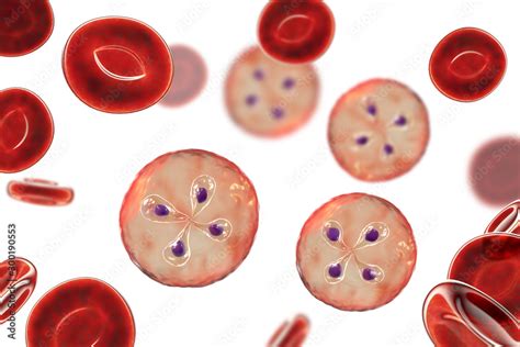 Babesia Parasites Inside Red Blood Cell The Causative Agent Of