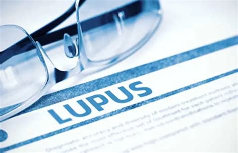 ICD 10 Coding For Systemic Lupus Erythematosus