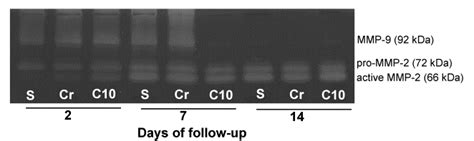 A Representative Zymogram Gel Gel Shows Proteolytic Activity Of MMPs