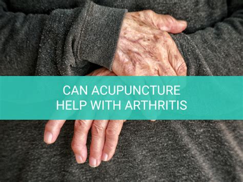 Can Acupuncture Help With Arthritis Pain Houston Acupuncture