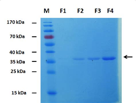 A Sds Page Gel Showing The Separation Of Purified Bjpsp Protein Of