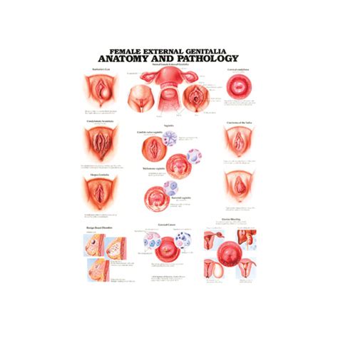 Anatomical Chart Female External Genitalia Anatomy And Pathology