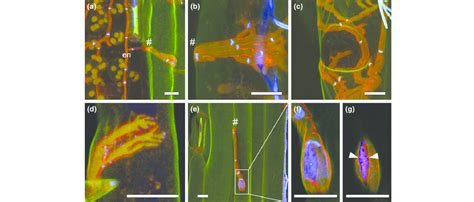 Subcuticular Hyphae And Cell Wall Changes Of Endophytic Hyphae Of The