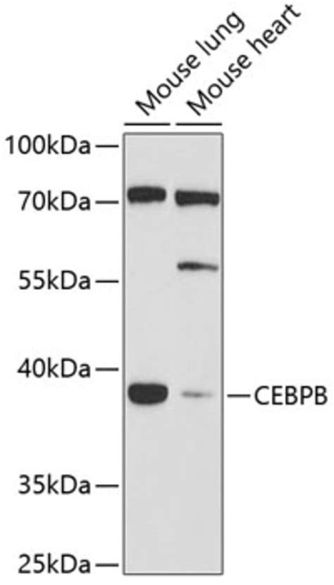 Anti Cebpb Antibody Produced In Rabbit