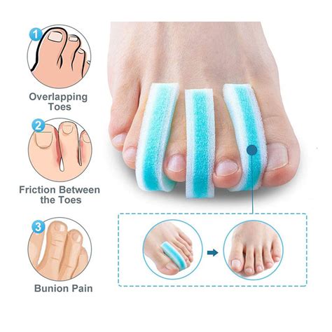 Breathable Foam Overlapping Toe Separator For Hammer Toes Suzhou Sunmed