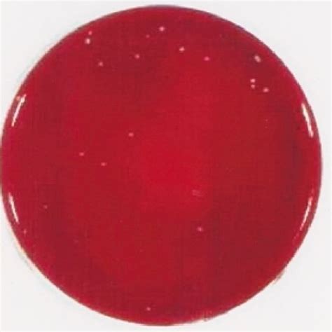 photograph showing bacterial growth   blood  plate   sample