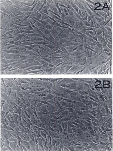 Figure From Activity Of Phorbol Ester Tumor Promoters On Enucleated