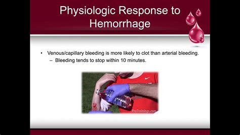 Symptoms Of Internal Bleeding