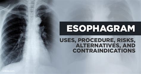 What Is Esophagram?